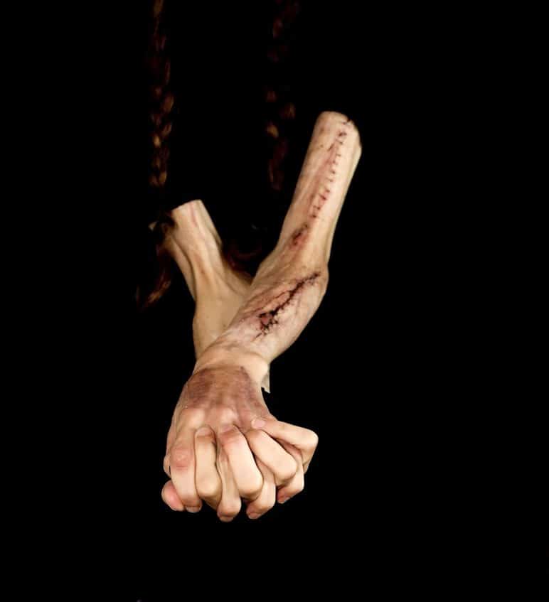 What Parents Should Know About Self-Harm in Teens